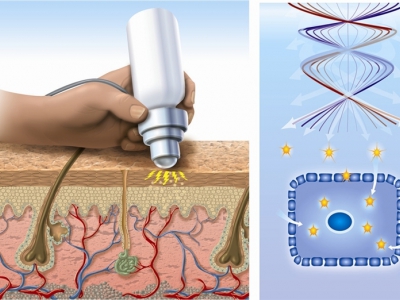 Electroporation 1